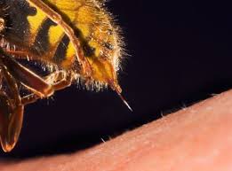 نیش زنبور یا دیگر حشرات ، نیش زنبور ، نیش پشه ، نیش حشرات ، درمان نیش حشرات در منزل ، مصرف آنتی هیستامین برای درمان نیش زنبور